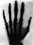 Tesla x ray hand